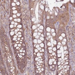 MRPS6 Antibody, Novus Biologicals 0.1mL; Unlabeled:Antibodies, Polyclonal